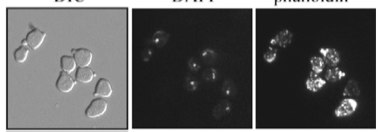 Figure from the 2007 Journal of Cell Science paper on Rot1 and Clb2