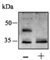 Figure from the 2010 FEMS Yeast Research paper on Rot1 targeting