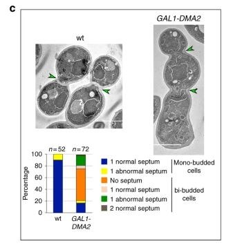 Figure associated with the 2018 Nature Communications paper on mitotic exit network recruitment and septin displacement