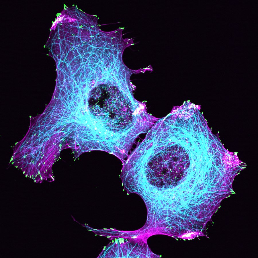 Figure from the 2019 Journal of Cell Biology paper on APC and focal adhesion turnover