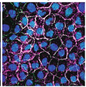 Figure from the 2023 book chapter on confocal imaging of cell junctions
