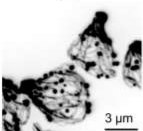 Electron micrograph of yeast cells with actin patches, associated with the 2024 Molecular Biology of the Cell paper on yeast formins Bud6 and Bil2